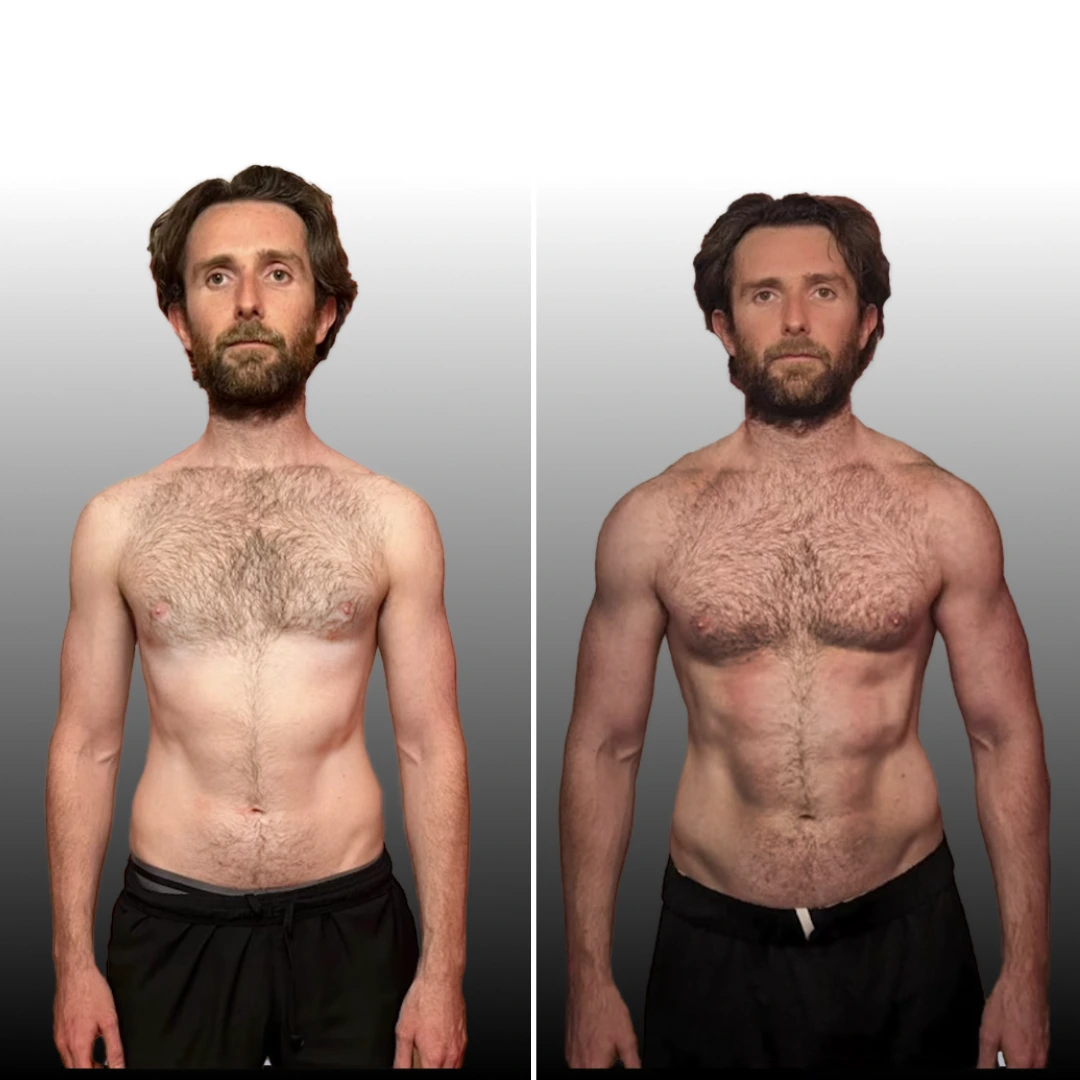 Before And After Callum Black Copy 2