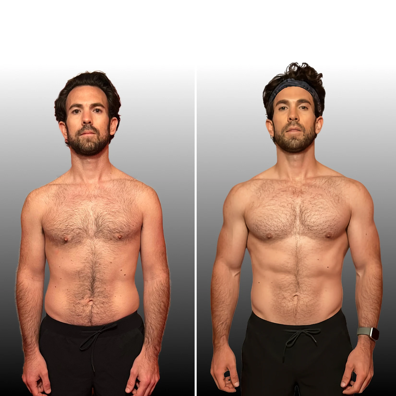 Stephen McLaughlin Before After Photo