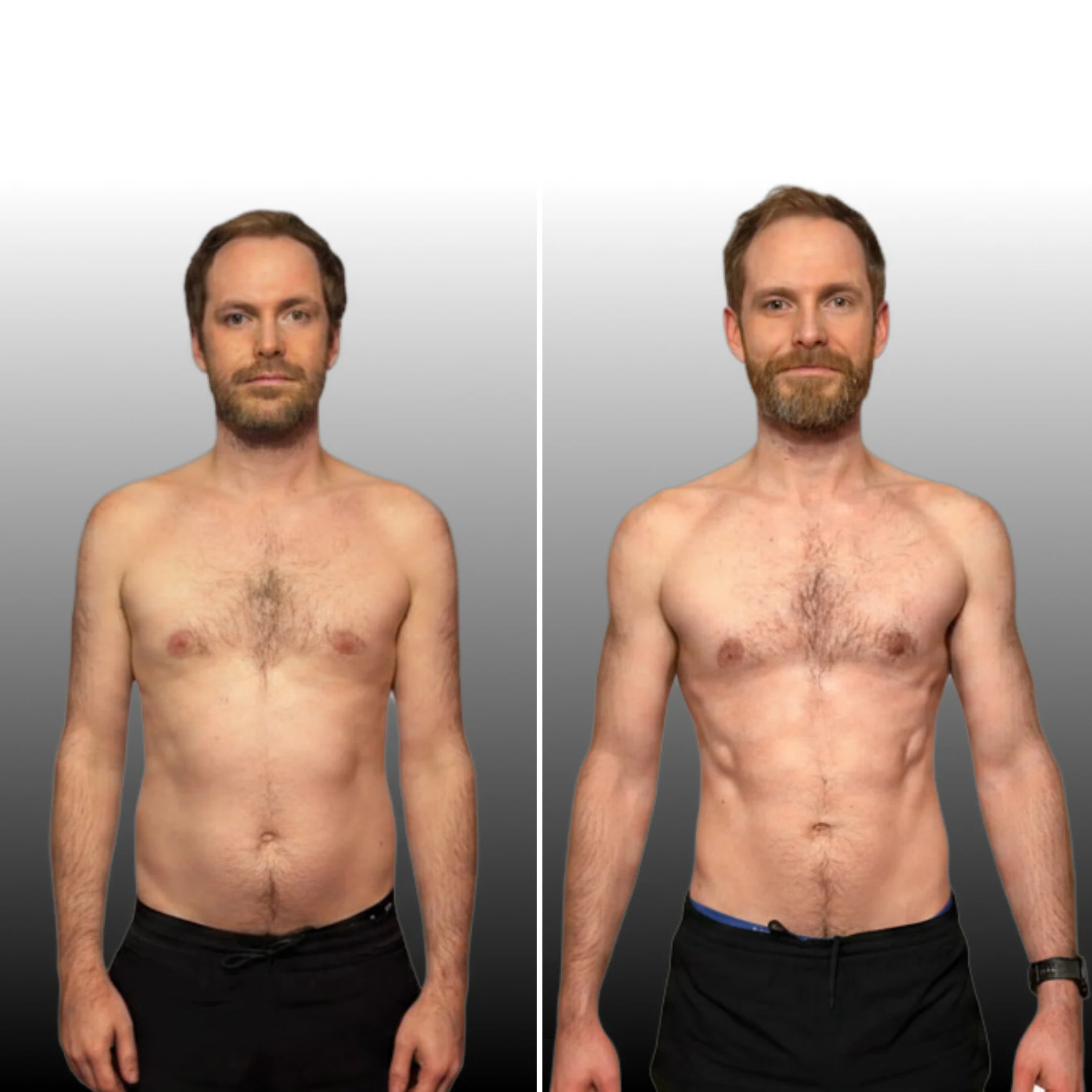 Chris mohan cmb before after2